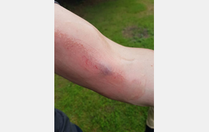 Ben oui, ça fait mal, mais c'est le métier qui rentre